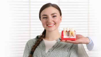 How Long Do Dental Implants Last?