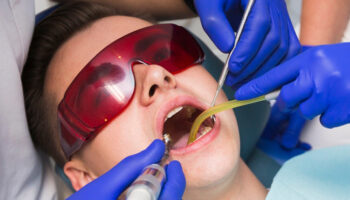 Busting Myths About Tooth Extraction