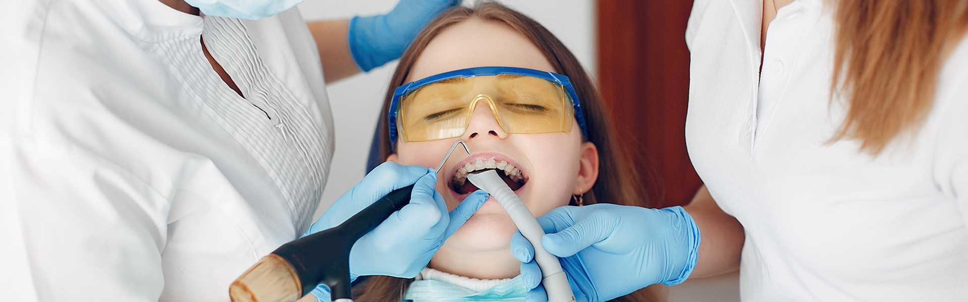 How Often Are Fluoride Treatments Recommended?