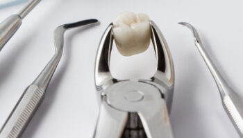 Can a Tooth Extraction Prevent Future Dental Problems?