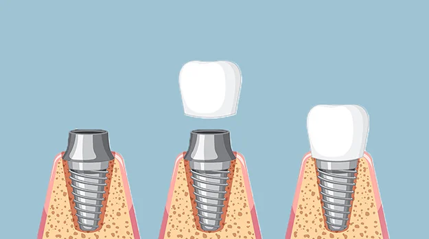 Consultation & Evaluation