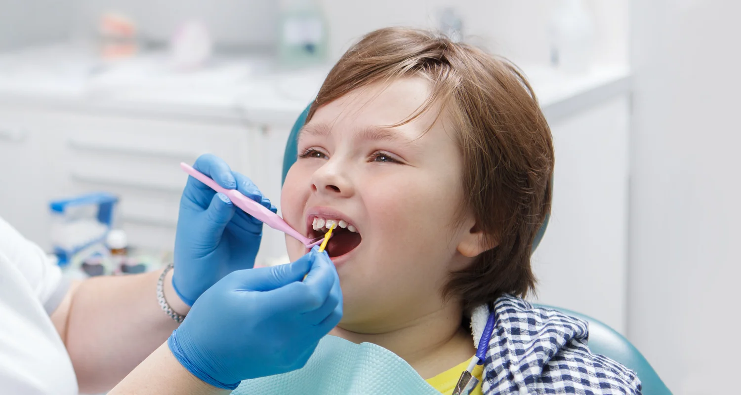 Fluoride Treatment in Kingwood, TX