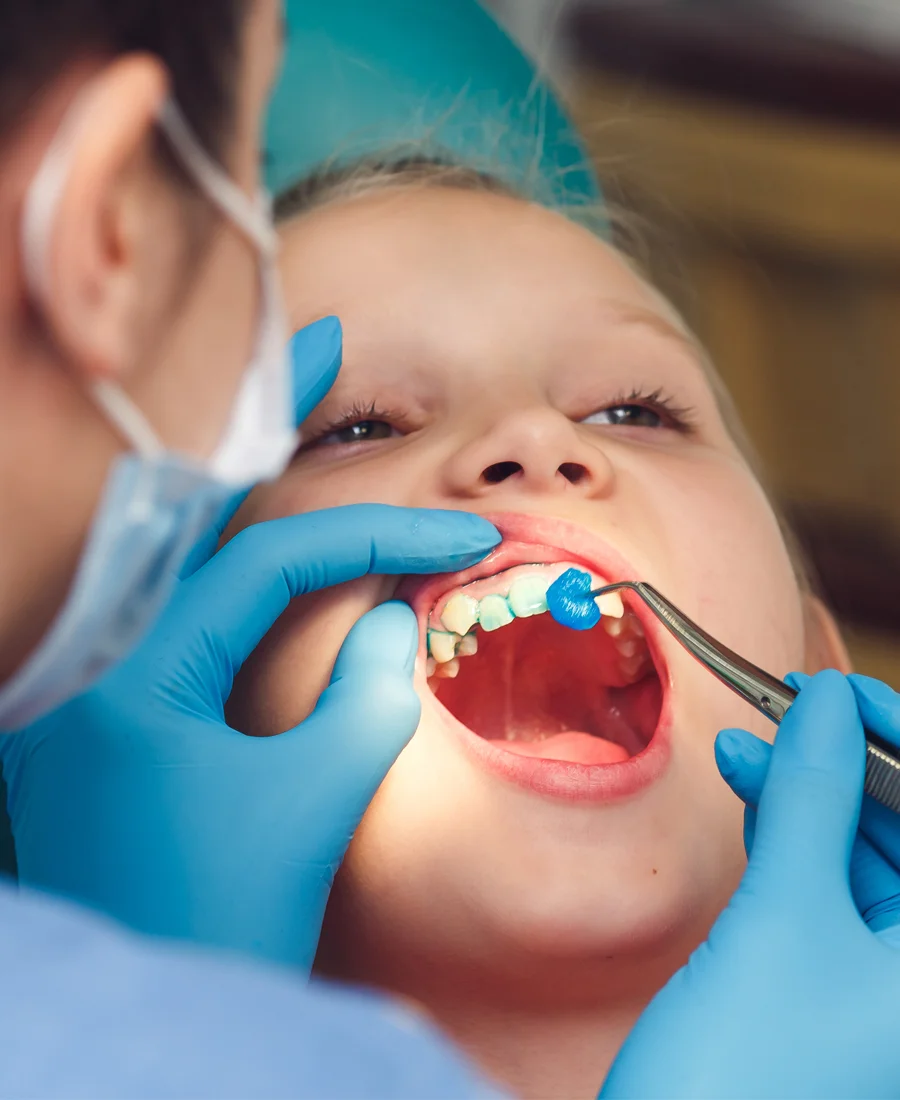 Why Choose Houston Oral Healthcare's Fluoride Treatment Specialist?