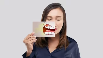 Does Gum Grafting Hurt? A Kingwood, TX Patient’s Guide to What to Expect