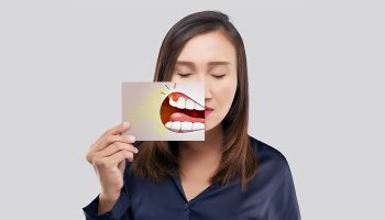 How Do I Know If I Need a Gum Graft? 7 Warning Signs Houston Patients Should Never Ignore